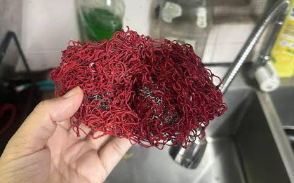 5 loại lưới rửa bát tiếc mấy cũng nên vứt ngay vào sọt rác!
