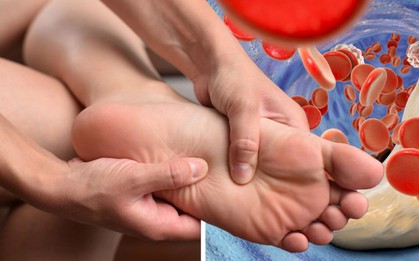 6 loại thực phẩm nếu ăn quá nhiều sẽ khiến axit uric trong máu tăng cao, "dẫn lối" cho bệnh thận và gout