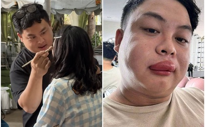 Cô dâu bị ong đốt, thợ make up đến “cứu” cũng bị đốt sưng môi: Người trong cuộc kể chuyện hy hữu