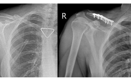 Thêm 1 du khách người Nga được bác sĩ cấp cứu kịp thời