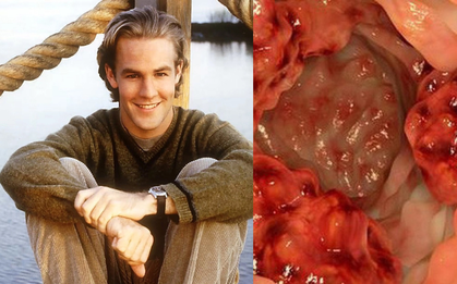 Sao phim "Ngã rẽ cuộc đời" qua đời ở tuổi 49 do ung thư: Bệnh đang trẻ hóa mức báo động, giới chuyên môn gần đây cảnh báo liên tục