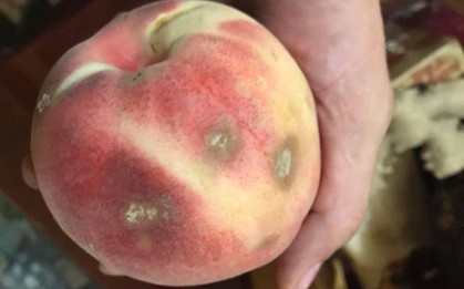 Ngày càng nhiều nam giới còn trẻ đã mắc ung thư gan, bác sĩ nói thẳng: 5 thứ này "phá gan" hơn bia rượu