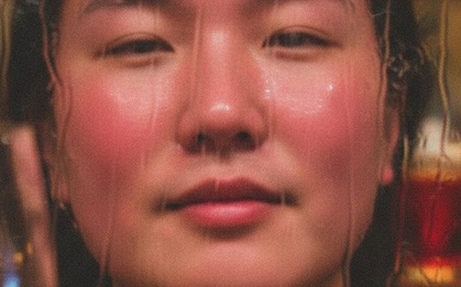 Đỏ mặt, nóng bừng sau uống rượu bia có đáng lo?