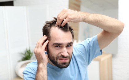 Hàng triệu người bị hói sớm chỉ vì 1 thói quen vô cùng phổ biến