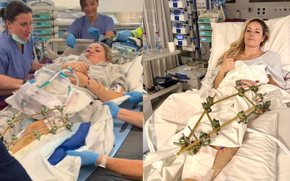 Huyền thoại trượt băng đối mặt nguy cơ cắt cụt chân sau tai nạn kinh hoàng tại Olympic 2026