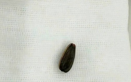 Bé 3 tuổi nguy kịch vì loại hạt thường có trên bàn tiếp khách dịp Tết