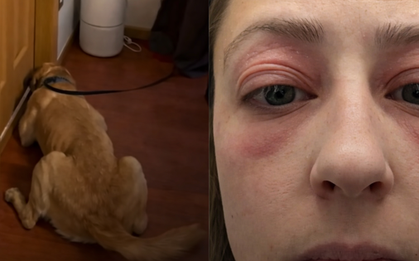 Bỏ 10 tỷ mua nhà, dọn vào ở được vài tháng, người phụ nữ mắc phải căn bệnh lạ khiến cơ thể biến dạng