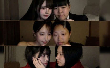 Trào lưu cực 'hot' ghép ảnh trước - sau thẩm mỹ bằng AI gây lo ngại