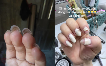 Cảnh tượng hãi hùng của những bộ nail sau Tết