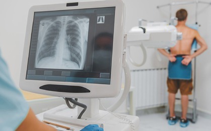 Chụp X-quang 'bấm là xong', sao phải chờ đủ 6 phút mới được BHYT thanh toán?