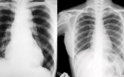 Vướng mắc thanh toán X-quang dưới 6 phút, BHXH Việt Nam lên tiếng