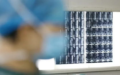 5 loại viêm tưởng nhẹ  thực chất là "chuông báo ung thư": Càng dập sớm, rủi ro càng thấp