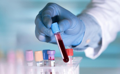 Xét nghiệm ung thư mới từ Mỹ có thể cứu nhiều người