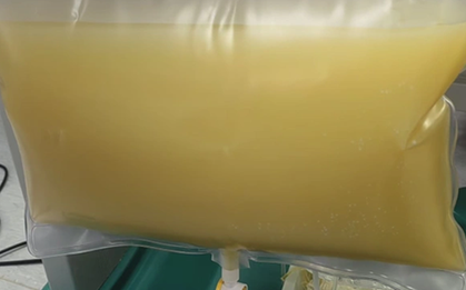 Nam sinh năm nhất "máu trắng như sữa", mỡ máu cao gấp 47 lần bình thường vì thói quen ăn uống nhiều người mắc