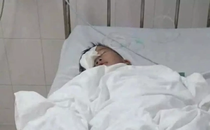 Xác minh vụ phụ huynh tố con học lớp 1 bị bạn chọc trúng mắt, rách giác mạc