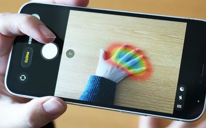 Chụp ảnh bàn tay, phát hiện được bệnh hiếm gặp