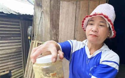 Hé lộ nguyên nhân món cá ủ chua khiến 3 trẻ ở Đà Nẵng nguy kịch phải nhờ sự trợ giúp từ WHO