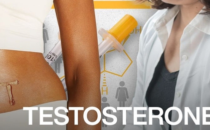 "Hormone nam giới" nhưng phụ nữ cũng cần: Vì sao ngày càng nhiều chị em tìm đến testosterone sau tuổi 40?