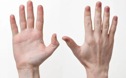 3 BẤT THƯỜNG ở bàn tay cảnh báo bệnh ung thư: Nhiều người gặp phải nhưng chủ quan bỏ qua
