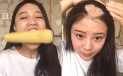 Cuộc sống sang chảnh hiện tại của “cô gái bị hói một mảng đầu vì ăn ngô bằng khoan” 10 năm trước