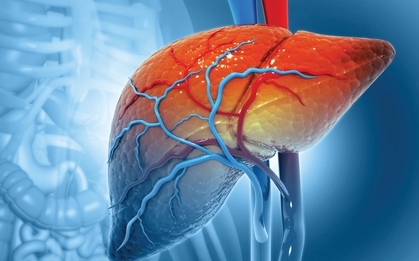 Ung thư gan tại Việt Nam gia tăng báo động: Kiểm soát được 3 thứ này, giảm được 2/3 số ca mắc
