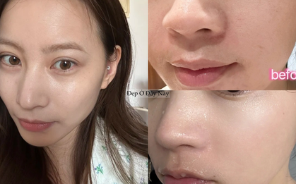 Tái sinh làn da trong giấc ngủ với 5 lọ serum đêm giá bình dân ai dùng cũng khen