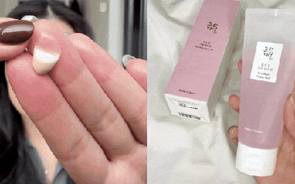 7 kem dưỡng ẩm Hàn dẫn đầu cuộc đua da căng mướt 2026: Đỉnh thôi nhé, da đẹp không cần filter