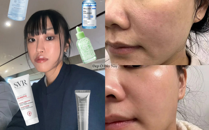 Chỉ 4 bước dưỡng da mỗi tối: Tôi "cứu vớt" được làn da khô căng, nếp nhăn li ti trở nên căng mịn