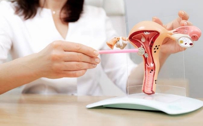 Phẫu thuật buồng trứng, tử cung có gây vô sinh? BS cảnh báo: Phụ nữ từng làm "2 loại phẫu thuật này" nên sớm bảo tồn khả năng sinh sản