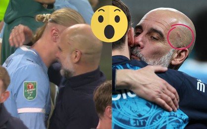 Vì sao HLV Pep Guardiola lại tự cào rách đầu khi Man City quật ngã Arsenal?