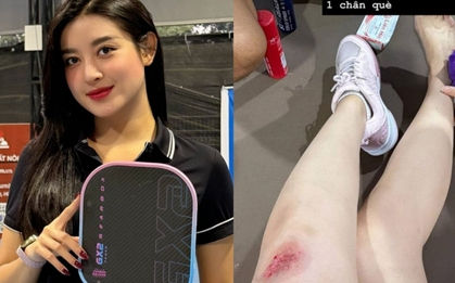 Á hậu Huyền My gặp tai nạn khi chơi pickleball