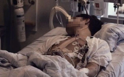 Nam sinh 18 tuổi tử vong vì ung thư đại trực tràng, bác sĩ: "Thủ phạm" là món thịt thơm lừng, trẻ em Việt rất thích