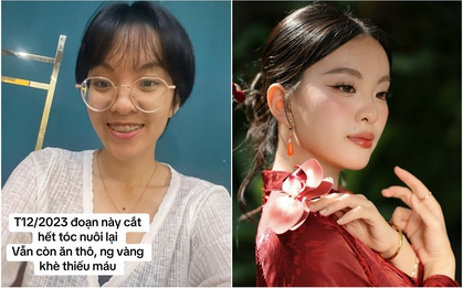 Màn thay đổi "đáng đồng tiền" của cô gái TP.HCM sau khi từ bỏ ăn thô, niềng răng và mổ mắt cận