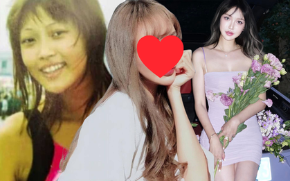 Cô gái cao 1m80 bị ép dao kéo từ năm 14 tuổi, hơn 300 lần phẫu thuật: Gương mặt hiện tại thế nào?