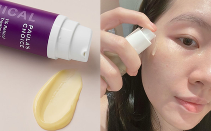 6 kinh nghiệm "xương máu" khi bôi retinol chống già, làm đúng da trẻ đẹp như hack