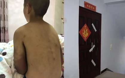 Bi kịch của cậu bé 14 tuổi vẫn phải mặc tã