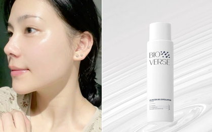 4 lọ toner "made in Vietnam": Giá bình dân nhưng dùng rồi mới thấy đáng tiền