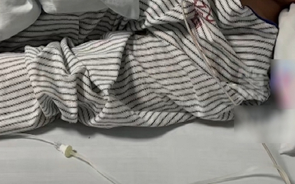 Chàng trai 30 tuổi mắt phải bỗng bị mờ, đi khám bác sĩ kết luận: Hệ miễn dịch đã bị tổn hại hoàn toàn