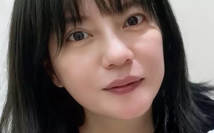 Tình trạng của Triệu Vy