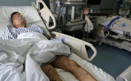 Người đàn ông suy thận vì mắc 1 sai lầm khi làm "chuyện ấy"