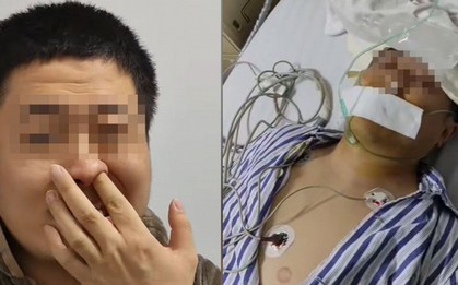 Người đàn ông bị tổn thương não vĩnh viễn vì xì mũi quá mạnh: Bạn có đang làm việc này đúng cách?