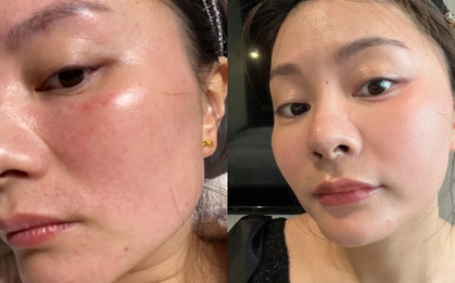 Tôi từng “ném tiền qua cửa sổ” vì mê spa, cho đến khi nhận ra: Chỉ cần 3 phút đắp lotion mỗi ngày, da cũng có thể đẹp lên