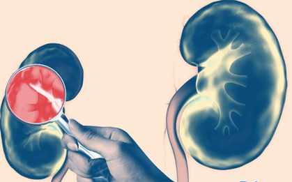 Bàng hoàng phát hiện suy thận sau khi có 1 dấu hiệu tưởng không liên quan