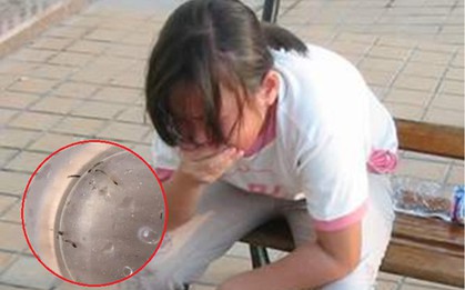 Bé gái nôn ra "giun sống" suốt hơn 1 tháng, thủ phạm lại là loài đang có trong nhiều gia đình