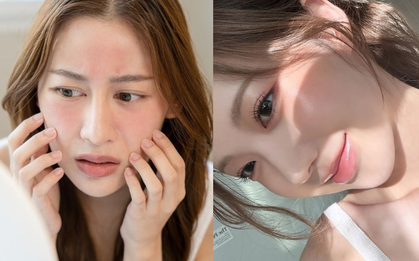 Da sạm nắng, sụt giảm collagen dù bôi kem chống nắng đầy đủ? Bác sĩ da liễu chỉ 5 lỗi sai cần tránh vào mùa hè