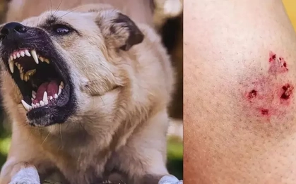 Chó 'điên' cắn 4 người ở Quảng Ngãi dương tính vi rút dại