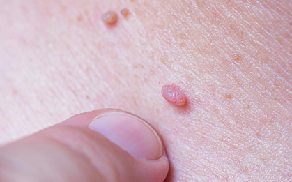 Phụ nữ từng quan hệ tình dục nên biết