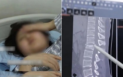 Dùng điện thoại khi làm 1 việc, cô gái có thể liệt 2 chân, tiểu không tự chủ suốt đời