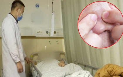 Nặn mụn trên mặt, người đàn ông 51 tuổi phát triển khối u ác tính