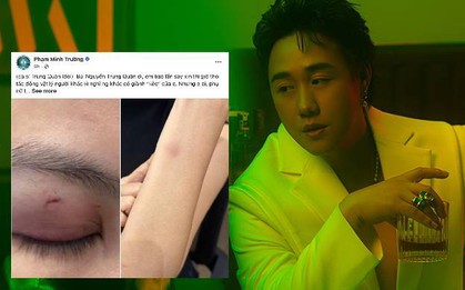 Nóng: Công an vào cuộc vụ ca sĩ Trung Quân Idol bị tố hành hung phụ nữ ở TPHCM